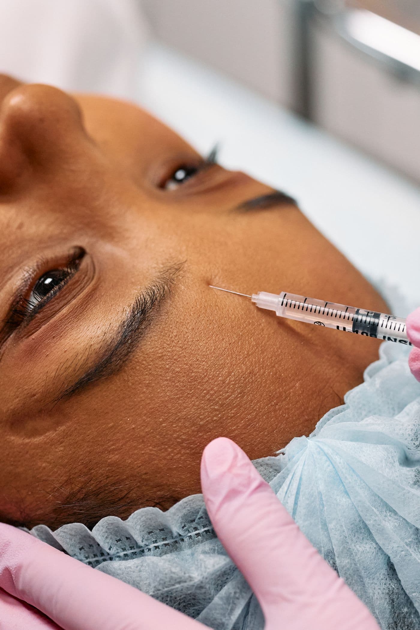 Dry Needling